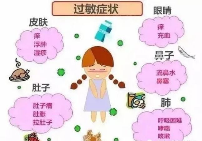 油漆过敏有哪些症状 油漆过敏有哪些症状图片