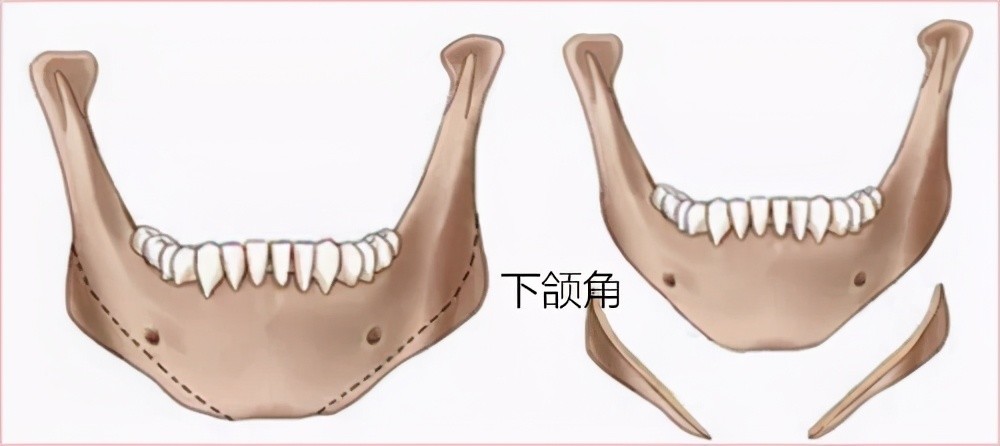 股票顶部锥子型k线 4个典型的顶部k线形态